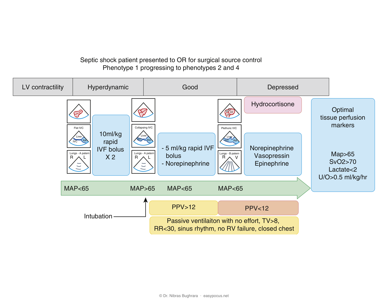 EASy management algorithm — Septic shock in the OR