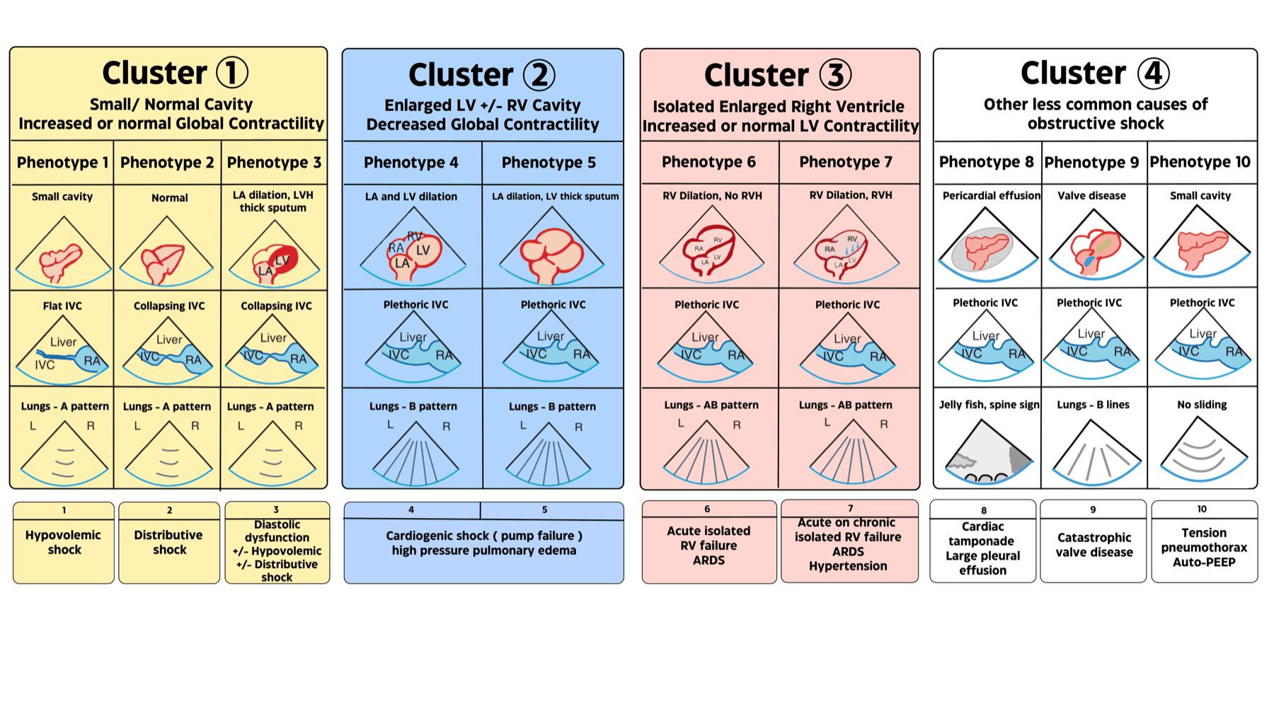 The EASy POCUS phenotype chart: 4 hemodynamic clusters (1 yellow small/normal cavity, 2 blue enlarged LV, 3 red isolated enlarged RV, 4 white obstructive) and 10 phenotypes, each showing the heart, IVC, and lung/pleura pattern with the corresponding shock diagnosis.